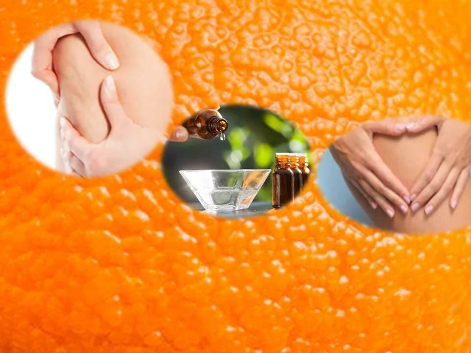 Как бороться с «апельсиновой коркой» и почему нужно посещать массажиста?