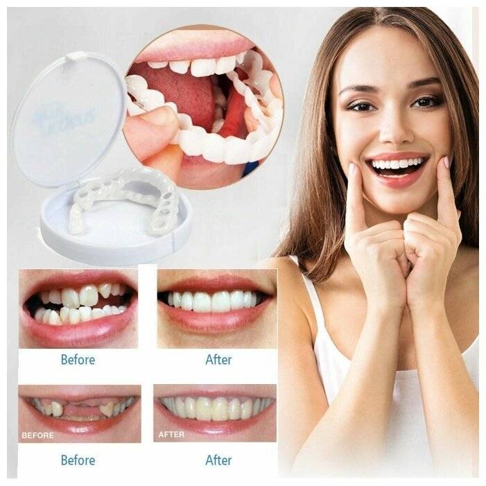 Как отбелить зубы — лучшие способы применяемые в стоматологии