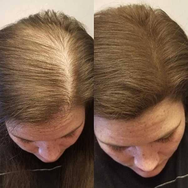 Как отрастить длинные и густые волосы: советы и рекомендации