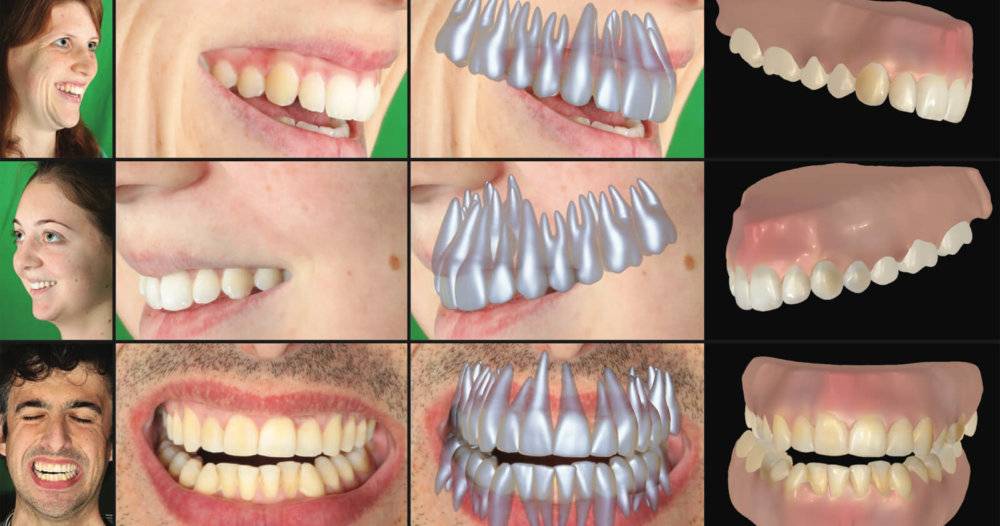 На сколько тонов можно отбелить зубы? ответ стоматолога