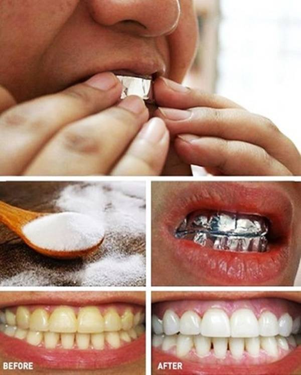 Как пользоваться полосками для отбеливания зубов: инструкция по применению