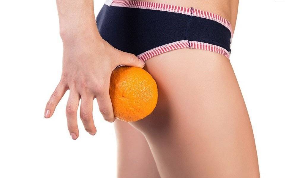 Как избавиться от апельсиновой корки?